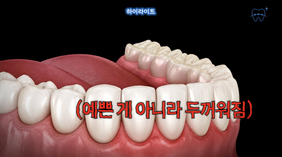 How to Make a Regret-Free Choice When Looking for a Recommended One-Day Laminate Dentist Near Nonhyeon Station image 4