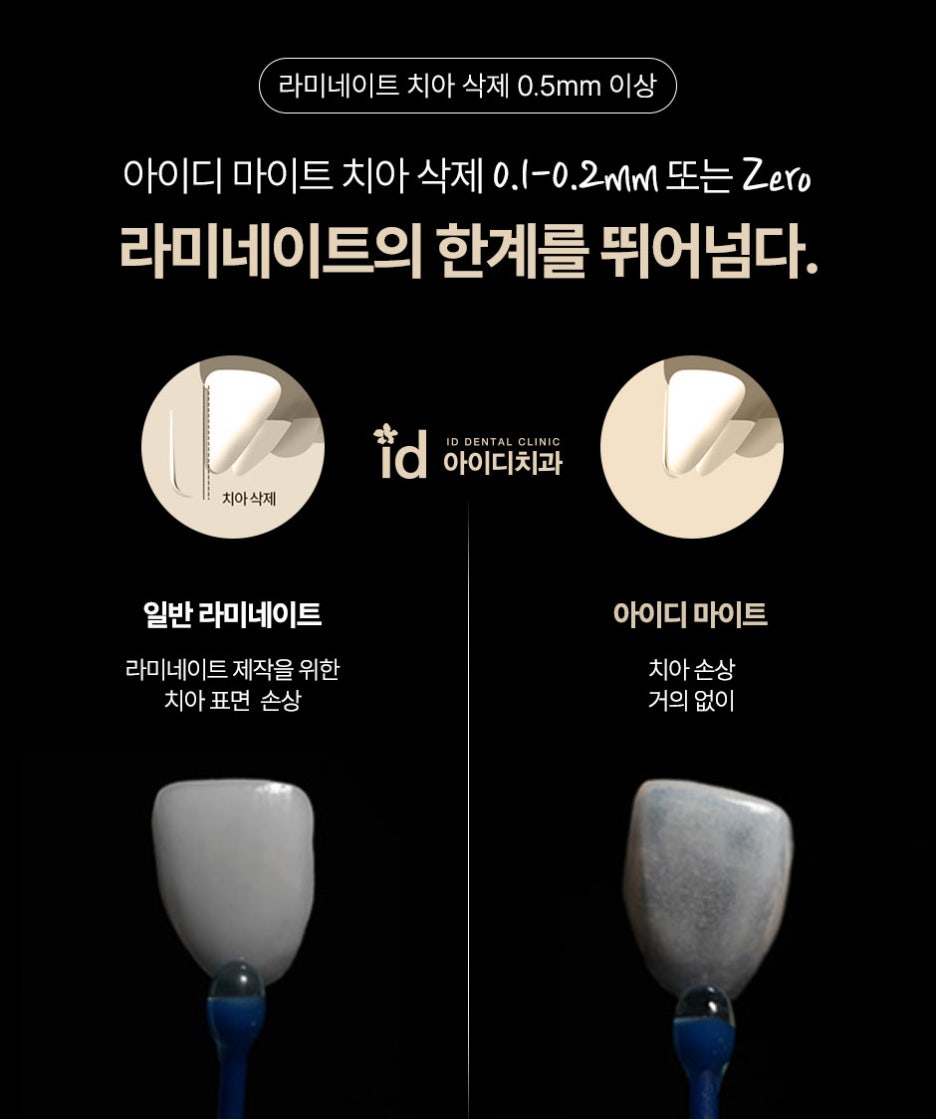 A Place That Considers the Health of Your Teeth for Veneers image 2