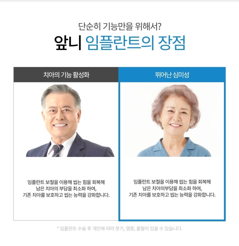 A Guide to Front Tooth Implant Treatment image 4