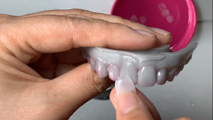 What to Check Before Deciding on Dental Laminates image 13