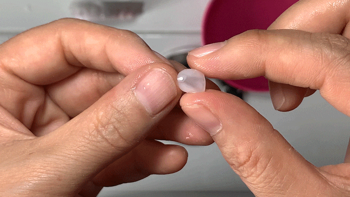 What to Check Before Deciding on Dental Laminates image 4