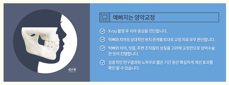 육지담 양악 달라진 비결 부정교합 치아교정에서 찾자 관련 이미지 3