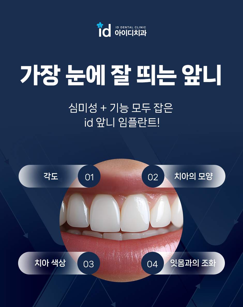 What Should You Check If You’re Afraid of Front Tooth Implants? image 9