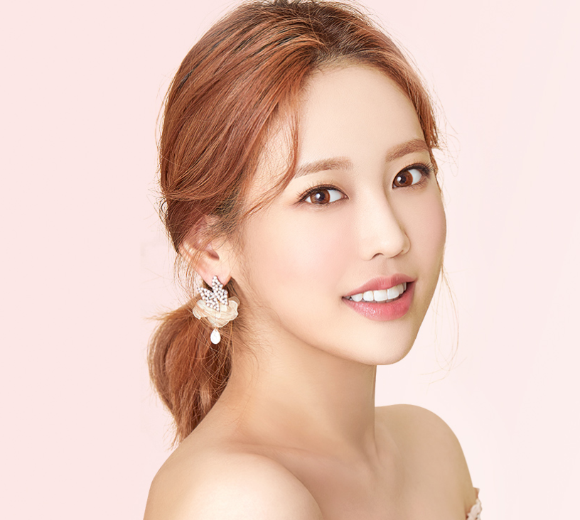 돌출입치아교정,무조건 수술만 고려할 필요 없어 관련 이미지 2