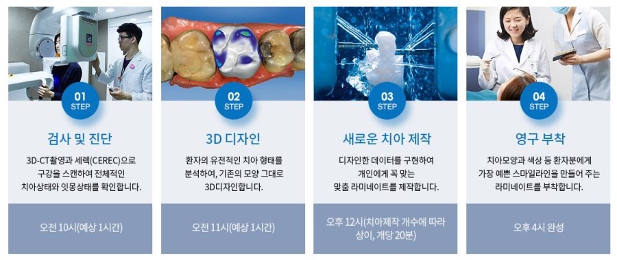 앞니라미네이트비용 빈틈없이 내것같은 앞니완성 관련 이미지 4