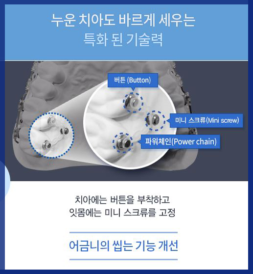 육지담교정 화제만발 예뻐진 그 비결 궁금하다면? 관련 이미지 4
