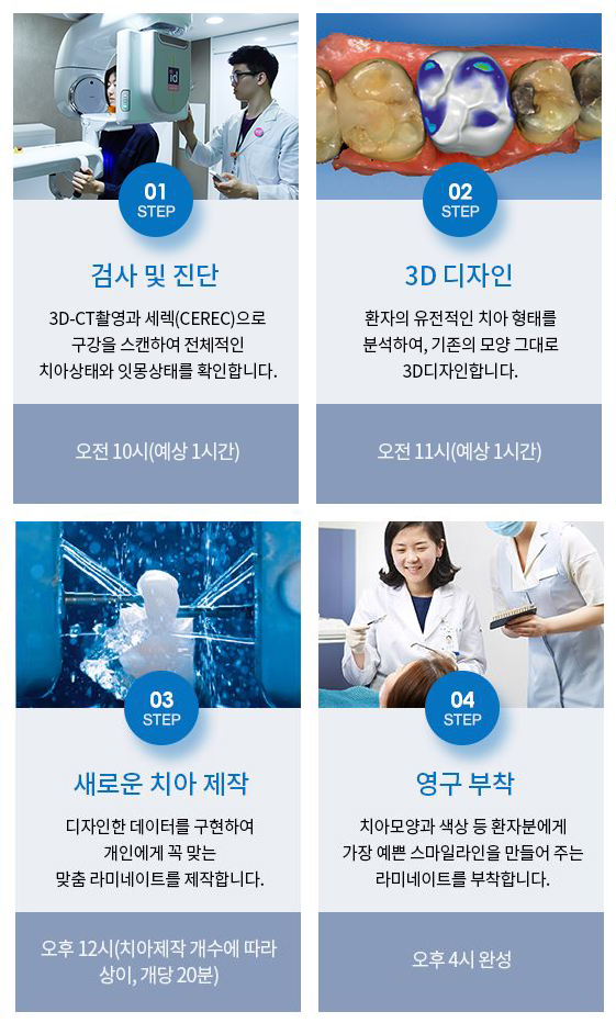 무삭제라미네이트 치아속까지 생각한다면 0.1이지 관련 이미지 6