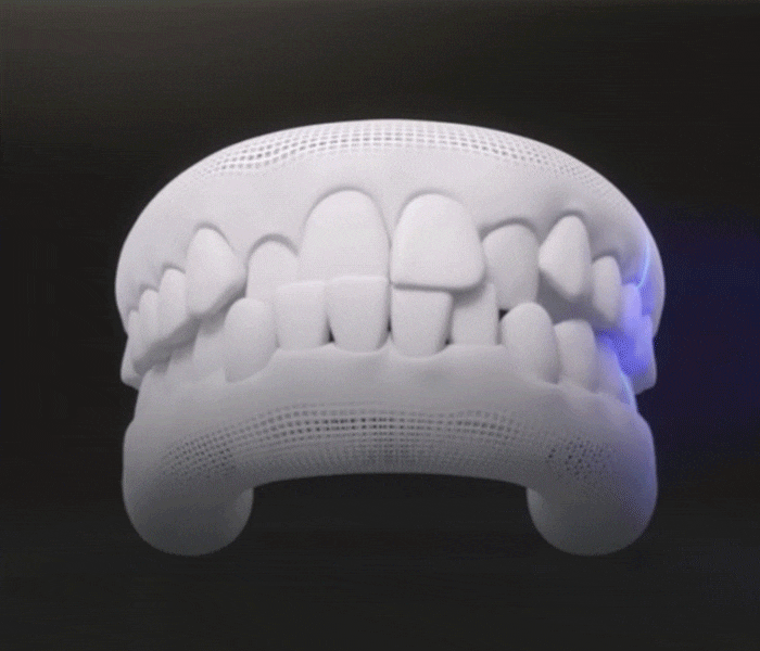 Gangnam Sinsa-dong Clear Aligner Dental Clinic: What Are the Criteria for Successful Orthodontic Treatment? image 5