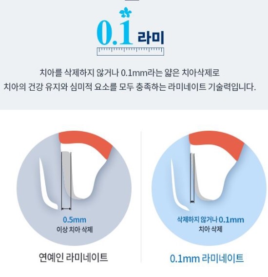 0.1라미 네이트 무리없이 깎아서 견고함을 높이다 관련 이미지 3
