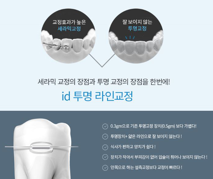 투명교정기 효과가 걱정된다면? 아이디 투명라인교정! 관련 이미지 3