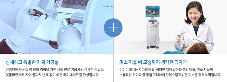 앞니라미네이트가격 만큼 슬림한 삭제량으로 관련 이미지 5