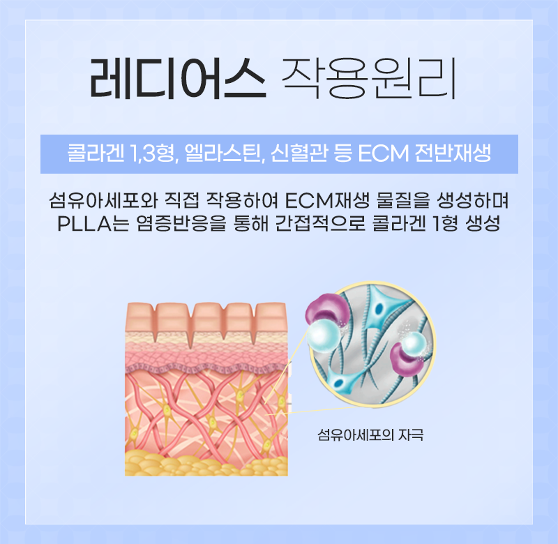 A Complete Guide to the Effects and Side Effects of the Collagen Booster Radiesse Procedure image 2