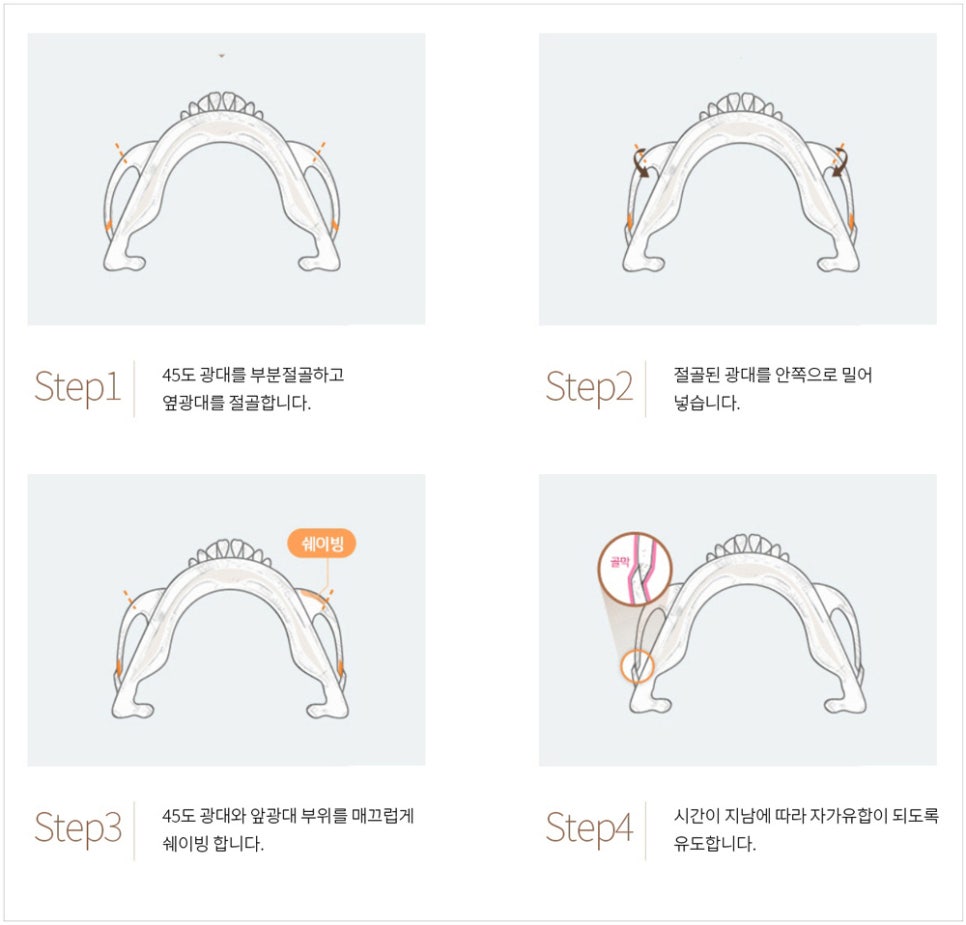 <span class="pcol3">[공지] 관련 이미지 1