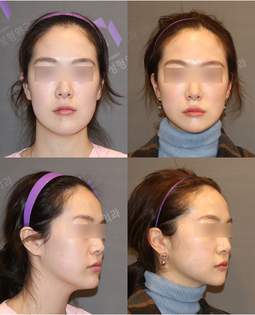 Should We Believe Every “Rumor” on Plastic Surgery Complication Cafes? image 2