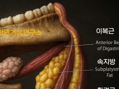 Why a Double Chin Remains After Contouring Surgery and How to Address It image 2