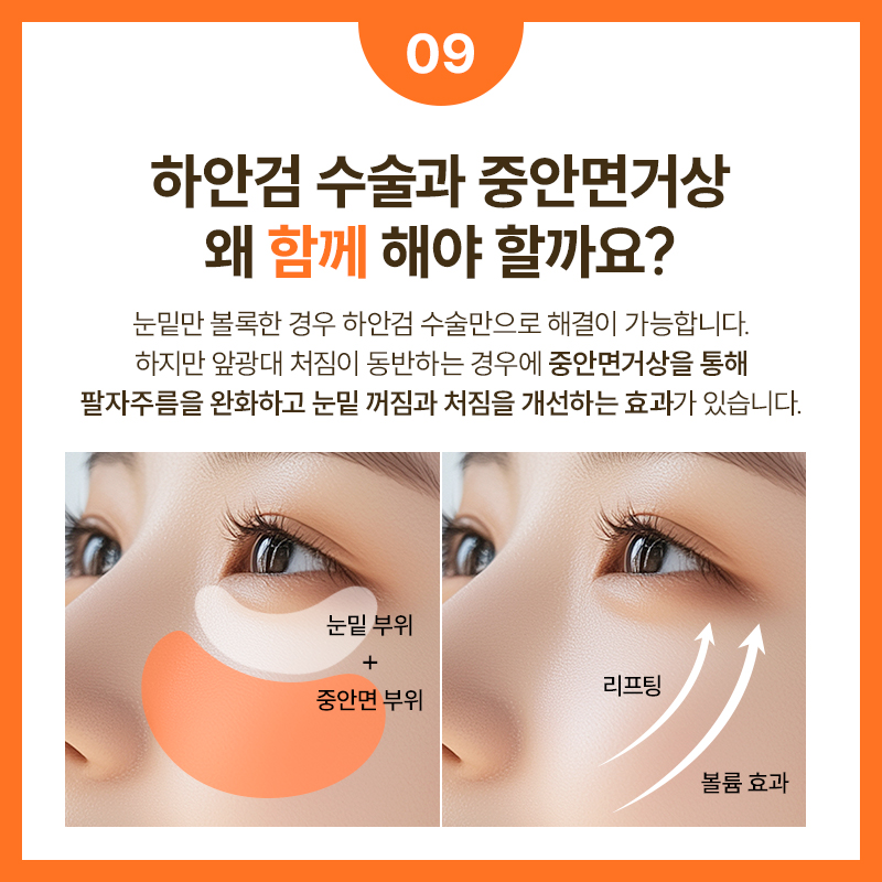 SMAS Facelift Effective for Improving Facial Sagging and Wrinkles image 10