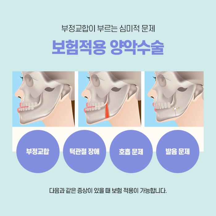 성형외과 수술 실비보험 청구할 수 있나요? 관련 이미지 4