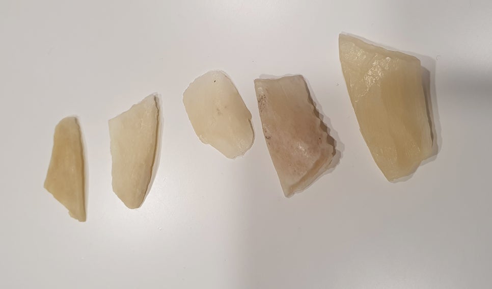 사각턱수술, 피질절골과 외측피질쉐이빙의 차이 관련 이미지 2