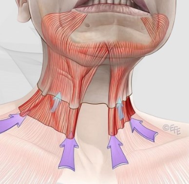 이중턱을 만드는 숨은 원인, 지방만의 문제가 아닙니다. 관련 이미지 3
