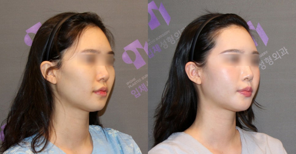 쉐이빙할 수 있는 부위와 효과는 어느정도 되나요? 관련 이미지 11