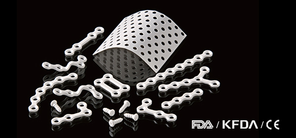 Is Pin Removal Surgery Necessary in Facial Contouring? Titanium Fixation Pins vs. Absorbable Fixation Pins image 1