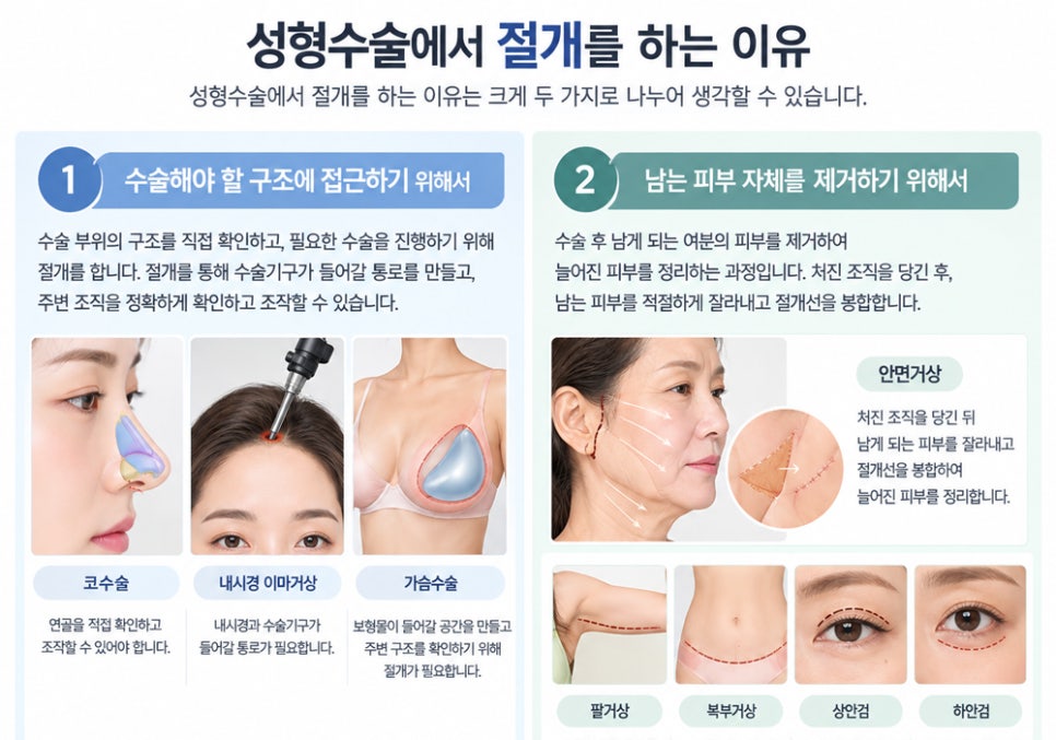 이중턱 근육묶기의 최소 절개와 해부학적 구조 관련 이미지 1