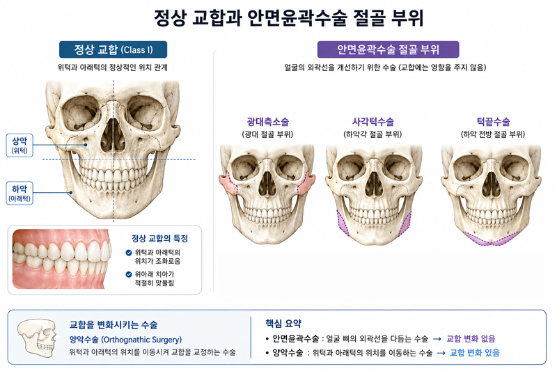 안면윤곽 수술 후 치아나 교합에 문제가 생길 수 있나요? 관련 이미지 1