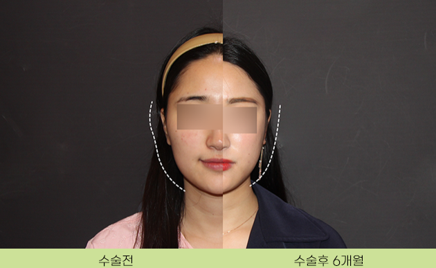 Facial Contouring, a Place That Does It Safely and Properly image 2