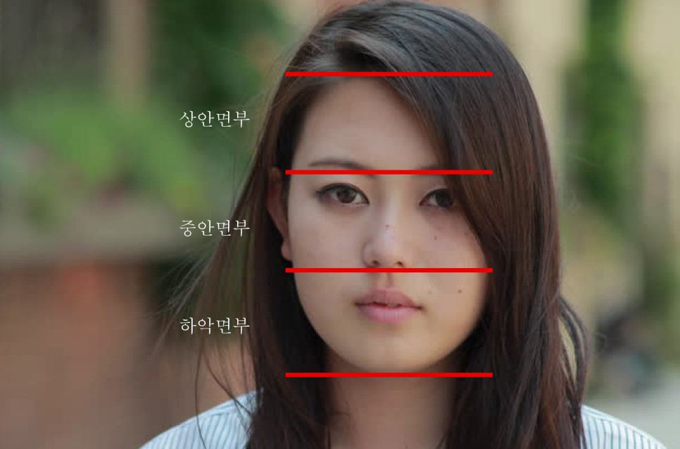 Long Chin, Long Face Contouring - Cases That Do Not Require Double Jaw Surgery image 1