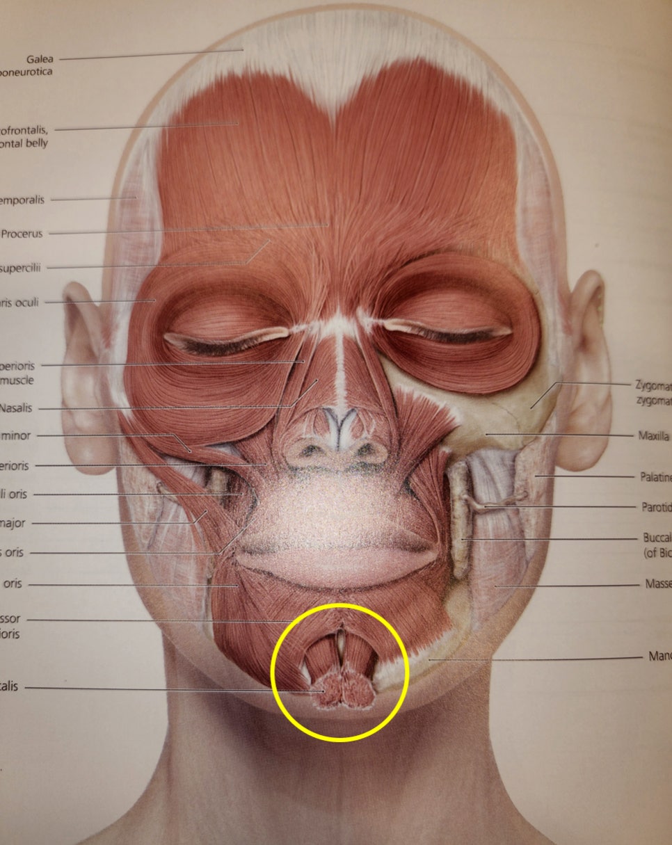Does chin filler or an implant cause bone erosion? image 9