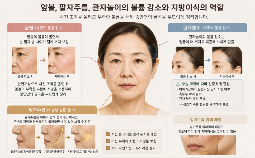 Is Fat Grafting Always Necessary When Undergoing a Facelift? image 3