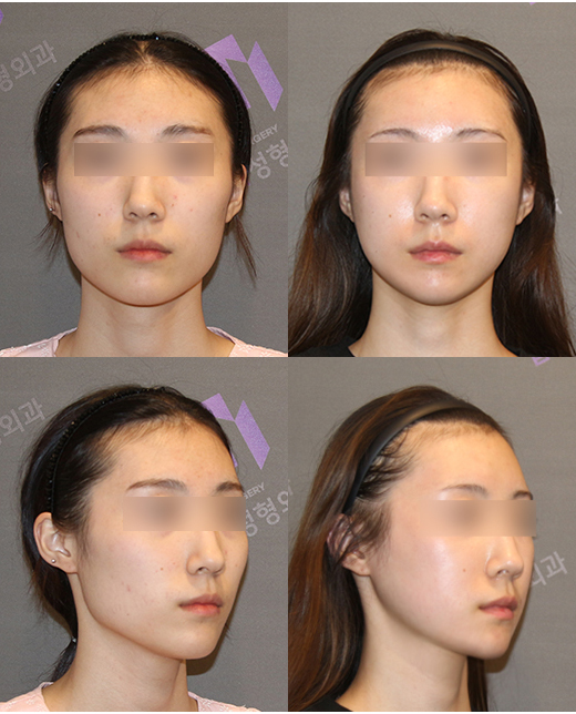 Should We Believe Every “Rumor” on Plastic Surgery Complication Cafes? image 3