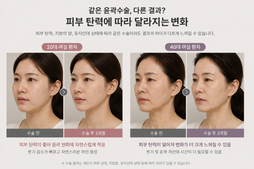 The Real Cause of What Feels Like Cheek Sagging After Contouring Surgery image 3