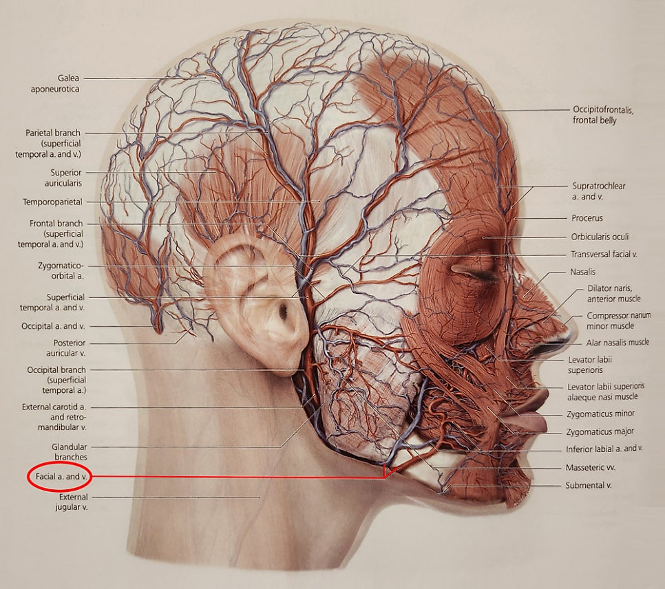 What kinds of massive bleeding can occur during facial contouring surgery? image 3