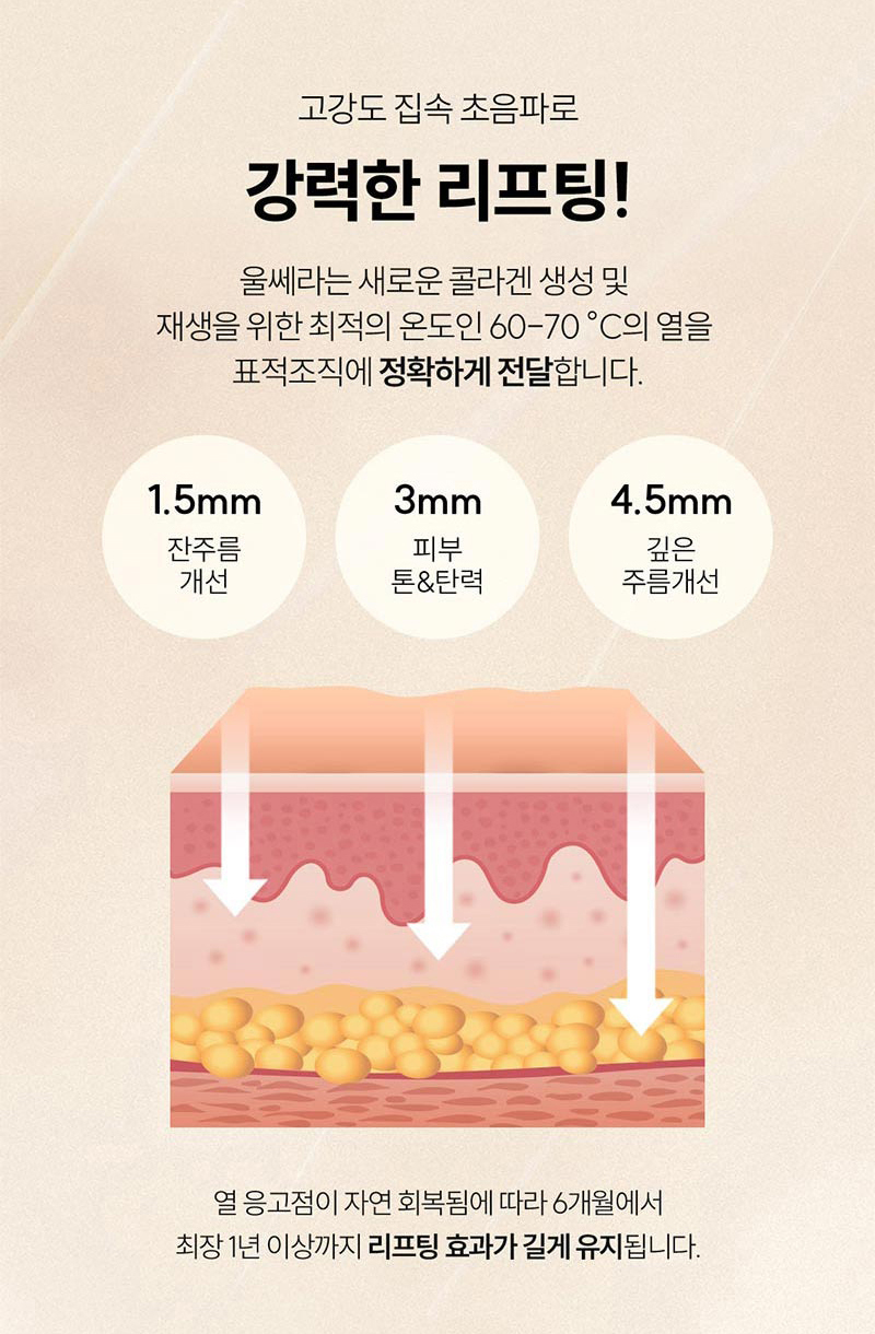 울쎄라 관련 이미지 2