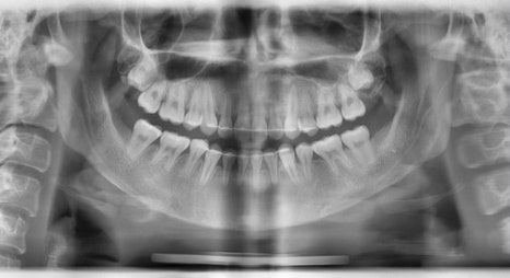 What Are the Features of a Youthful Face? Why Does a Small Chin Make a Face Look Younger? image 7