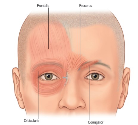 Why Do Eyebrows Sag Lower as We Age? - A Forehead Lift May Be the Solution. image 2
