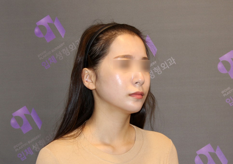 안면윤곽 연예인 고윤정, 카리나 얼굴형처럼 예뻐질 수 있을까요? 관련 이미지 6