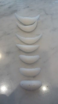 What Surgery Is Best for Correcting a Recessed Chin? The Limits of Chin Advancement Surgery and the Actual Results image 6