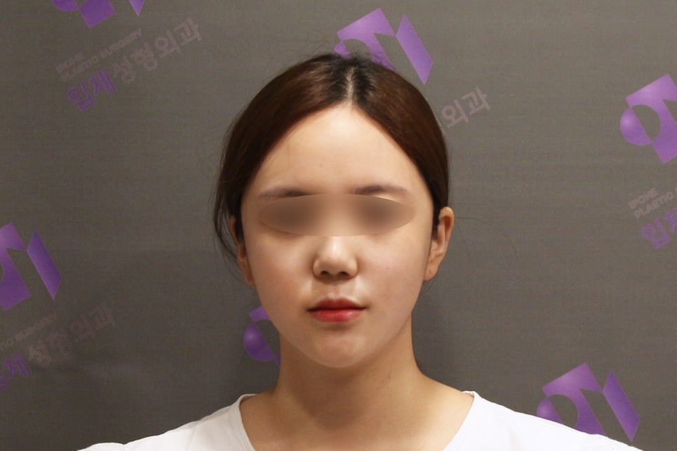 안면윤곽연예인, 연예인들은 왜 갈수록 예뻐질까요? - 성형외과 전문의가 직접알려드립니다. 관련 이미지 3