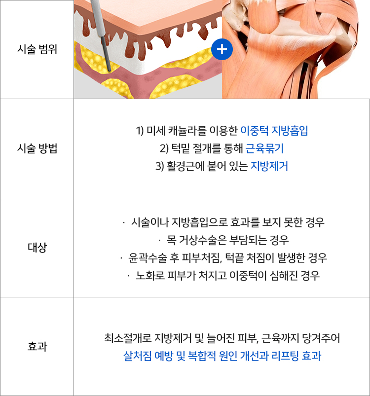Let’s Take a Closer Look at Submental Muscles and Submental Muscle Tightening for a Double Chin image 4