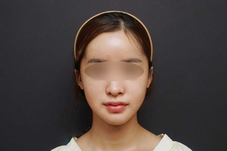 안면윤곽연예인, 연예인들은 왜 갈수록 예뻐질까요? - 성형외과 전문의가 직접알려드립니다. 관련 이미지 8