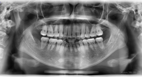 Consultation and Design Before Facial Contouring Surgery image 7