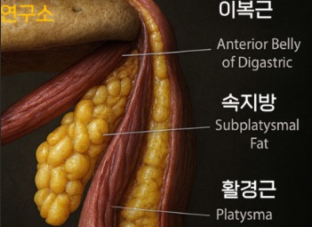Why a Double Chin Remains After Contouring Surgery and How to Address It image 4