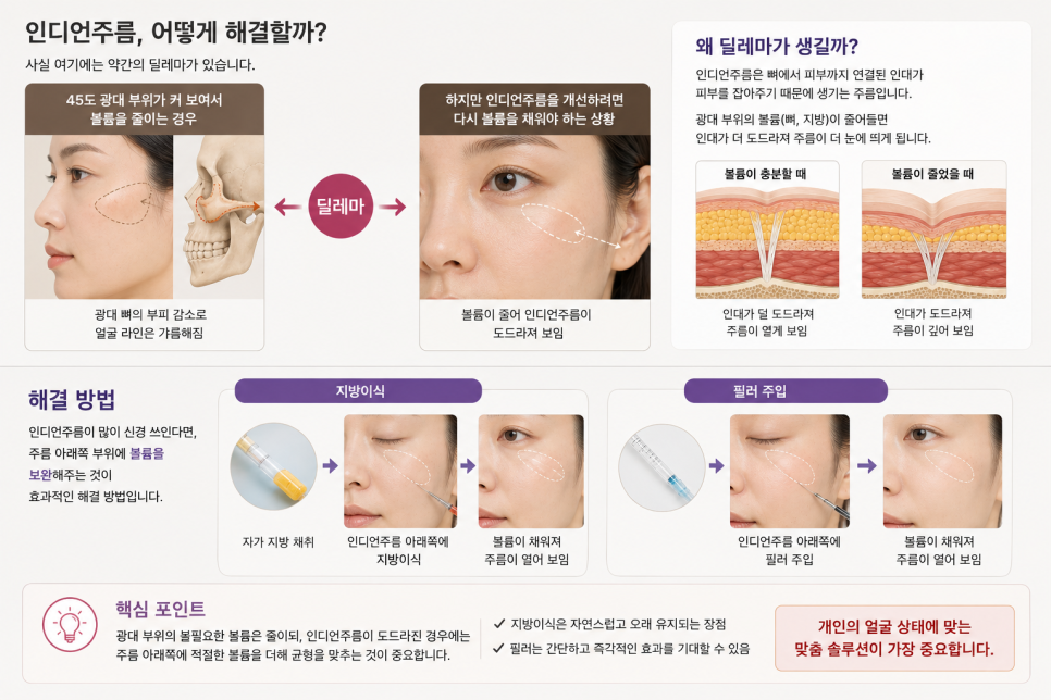 인디언주름의 원인, 광대축소 수술 때문일까? 관련 이미지 4