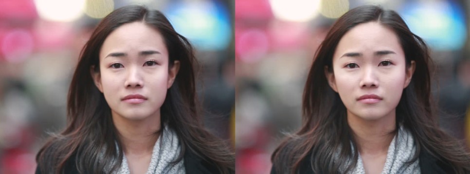 [칼럼] 안면윤곽성형 정면효과, 수술 후 어색한 얼굴은 왜 그럴까요? 관련 이미지 1