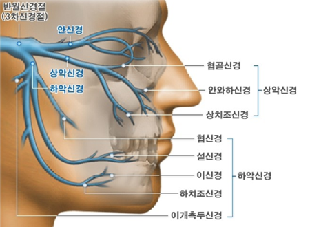 양악수술 후 부작용은 어떤 것이 있을까요? 관련 이미지 1