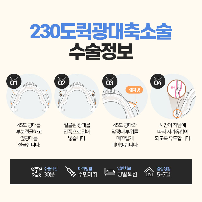 안면윤곽수술, 처음부터 끝까지 A to Z 관련 이미지 7