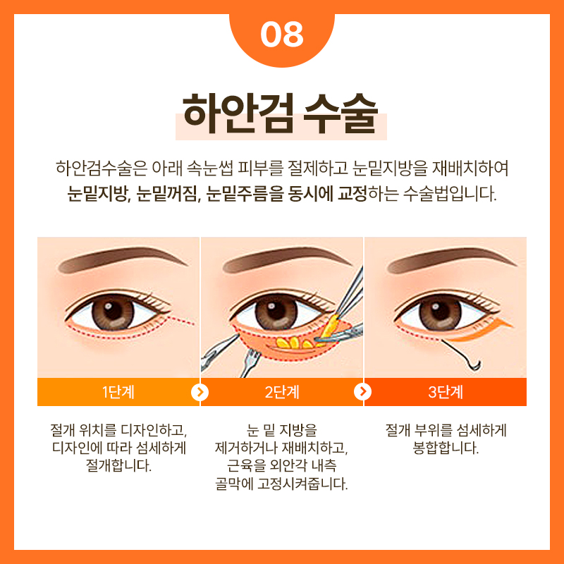 SMAS Facelift Effective for Improving Facial Sagging and Wrinkles image 9