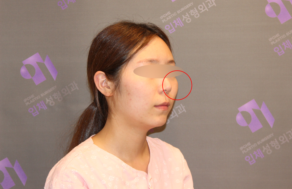 안면윤곽수술비용, 비쌀수록 좋은걸까요? -전문의가 알려드립니다. 관련 이미지 4